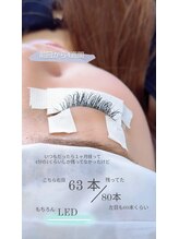 ノリト(norito)/施術4週間後