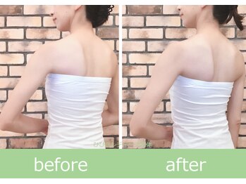 ひびきレディース整体 日吉/ドレスが映える美姿勢ブライダル