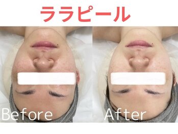 ライズ 岩見沢店(RISE)/【ララピール】ビフォーアフター
