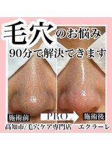 エクラーレ(Eclale)/【毛穴ケア】症例