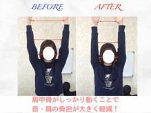 タイナ 岡山(taina)/猫背・巻き肩矯正