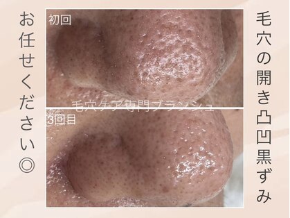 ブランシュネイル(BLANCHE Nail)の写真