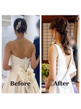 ライズ/お客様のビフォーアフター