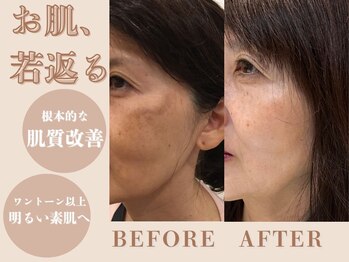 ルージュアッシュ(ROUGE.H)