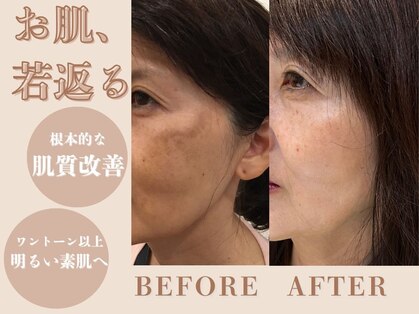 ルージュアッシュ(ROUGE.H)の写真