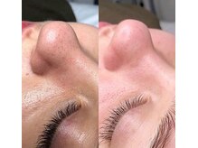 ハウピア 烏丸(Haupia)/【毛穴のサイズを小さく】