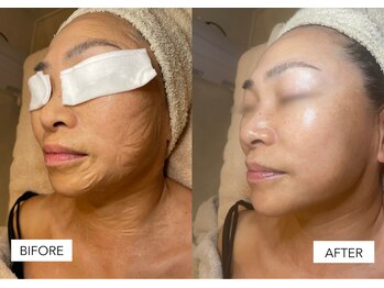 エングラッシー(en glassy)/BEFORE　AFTER　50代