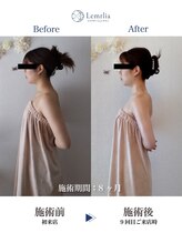 レムリア(Lemrlia)/ブライダル