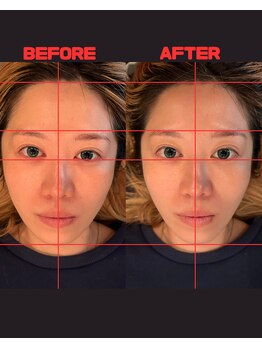 ジェイペック鍼灸整骨院/BEFORE→AFTER