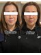 シェリー(SHELLY)の写真/【小顔×肌質改善】肩甲骨や首・肩・顔の筋肉をほぐして骨格までアプローチ。ハーブピーリングと相性抜群。