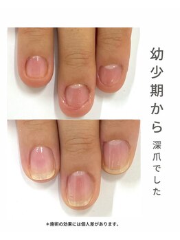 最強ネイルケア