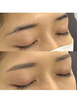 ヘキサ 千葉店(HEXA)/【アイブロウ】ビフォーアフター