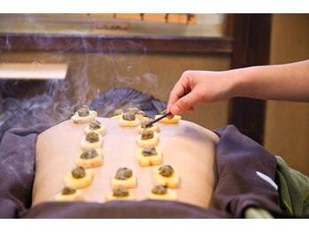 中村温灸院/背中のしょうが灸