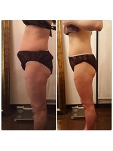 ラベルヴィ(La belle vie)/結果重視・痩身エステのお客様