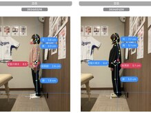 ナオル整体 宮崎院(NAORU整体)/20代女性施術事例【立位側面】