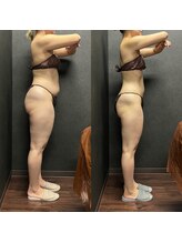 リノ(Lino)/食事制限なし！半年で11キロ減！