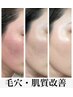 【疲れ肌・くすみ徹底改善】　ハーブピーリング　初回体験