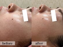 エステサロン ジョアアンジェ(joie ange)/SNSで話題の韓国肌管理