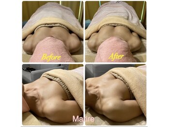マリール(Marire)/40代　施術1回