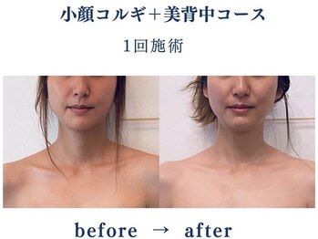 シンシア(sincere)/1回でも効果有り!