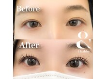 シンプルジョイ(Simple joy)/アンドヘルシー（＆ヘルシー）