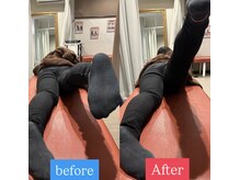 ナオル整体 宮崎院(NAORU整体)/20代女性施術事例【反り腰改善】