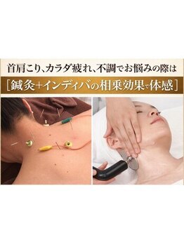 フィットジユウガオカ(Fit_Jiyugaoka)の写真/【インディバと鍼灸の相乗効果】肩こり/冷え/自律神経の乱れを劇的改善◎冷えない体づくり