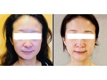 サロンモコ(Salon Moco)の雰囲気（頭皮ケア/髪質改善/体の痛み/肩こり/肩甲骨/たるみ/シワ）