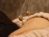 【美容鍼灸整体】小顔＋全身整体で健康的で美しく☆☆