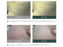 ルカ 北堀江(Luca)/毛穴レス水光肌へ