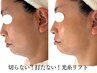 【切らない!打たない!光糸リフトでリフトアップ】たるみ・しわ・毛穴改善◎