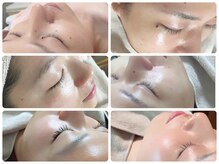 アップル マリー 札幌桑園の雰囲気（産毛・毛穴ケアで艶々肌、メイクのりUP☆忙しい大人女性の肌ケア）