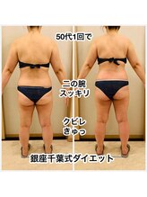 ヒーリングユー(Healing you)/５０代ビフォーアフター