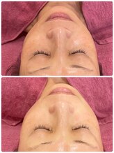 ファビリス 仙台ロフト店(FAVILIS)/【フェイシャル】美肌美白1回