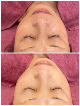 ファビリス 仙台ロフト店(FAVILIS)/【フェイシャル】美肌美白1回