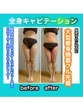 ビューティ ウィッチ(Beauty Witch)/