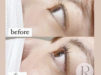 リリン(Ririn)/Before After◎