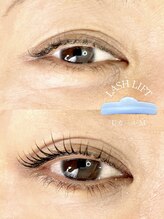 ラヴール(LOVE REUX)/Before/After【ラッシュリフト】