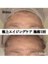 ステラ(Stella)/極上のエイジングケア