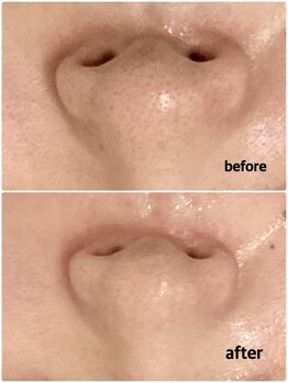 アイズ 横浜店(ize)/