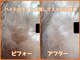 リンク(rinc。)の写真