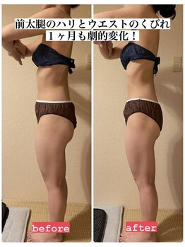 ヨサパーク ハット(YOSA PARK HAT)/ウエストのくびれ取り戻したい!