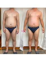 リリーローズ(LilyRose)/おなかやせ