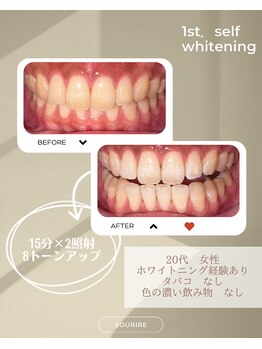 スリール(sourire)/