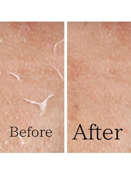 レティティア(Laetitia)/セラピールを6回目のお客様