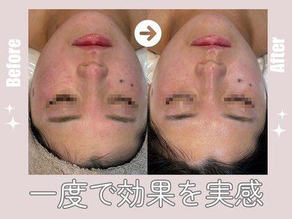 芯美 恵比寿店(shinbi)の写真