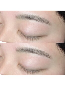 アルピナ アイラッシュ(alpina eyelash)/美眉♪