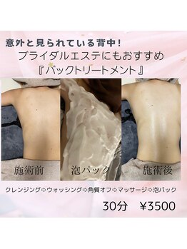 ムム(MooMoo)/バックトリートメント