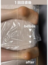 メゾン ド クロエ(Maison de Chloe)/CHLOE式パーソナル痩身