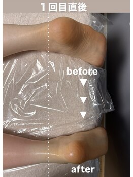 メゾン ド クロエ(Maison de Chloe)/CHLOE式パーソナル痩身